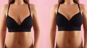 Breast Reduction Surgery Cost