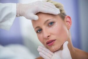 Mini Facelift Guide