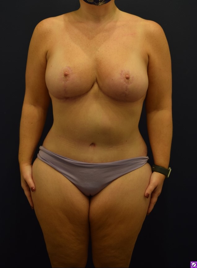 After Image