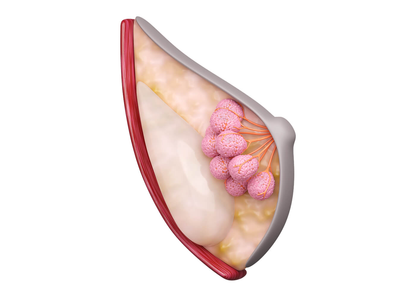 3D rendering of a breast with mammary glands, breast tissue, a breast implant, and the pectoral muscle.