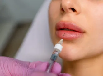 Cosmetic professional applying lip filler with a syringe.